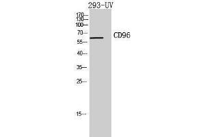 Western Blotting (WB) image for anti-CD96 (CD96) (Internal Region) antibody (ABIN3181440) (CD96 anticorps  (Internal Region))