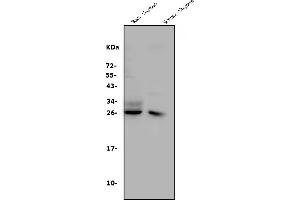 Western blot analysis of CD8 alpha/Cd8a using anti-CD8 alpha/Cd8a antibody (ABIN7601570).
