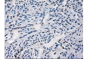 Immunohistochemical staining of paraffin-embedded Ovary tissue using anti-CYP2E1 mouse monoclonal antibody. (CYP2E1 anticorps)