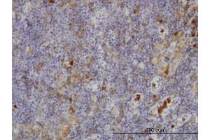 Immunoperoxidase of monoclonal antibody to FGR on formalin-fixed paraffin-embedded human lymph node. (Fgr anticorps  (AA 1-90))