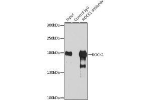 Immunoprecipitation analysis of 200 μg extracts of 293T cells, using 3 μg ROCK1 antibody .