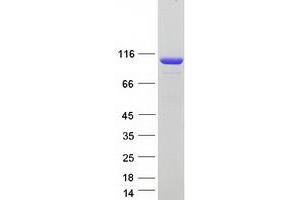 Rabaptin, RAB GTPase Binding Effector Protein 1 (RABEP1) (Transcript Variant 1) protein (Myc-DYKDDDDK Tag)
