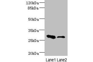 Western blot All lanes: EAF2 antibody at 3. (EAF2 anticorps  (AA 1-170))