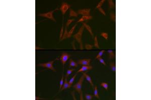 Immunofluorescence analysis of NIH/3T3 cells using STA Rabbit pAb (ABIN6128540, ABIN6148576, ABIN6148578 and ABIN6223670) at dilution of 1:50 (40x lens). (STAT5A anticorps  (AA 635-794))