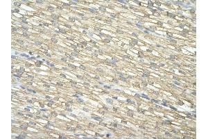 anti-IMP3, U3 Small Nucleolar Ribonucleoprotein (IMP3) (Middle Region) antibody