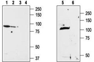 Western blot analysis of ND7/23 cell line membrane (lanes 1 and 3), RBL lysates (lanes 2 and 4) and rat brain membrane (lanes 5and 6): - 1,2,5. (TRPV2 anticorps  (1st Extracellular Loop))
