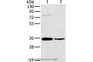 Western blot analysis of 293T and skov3 cell, using OTUB1 Polyclonal Antibody at dilution of 1:570 (OTUB1 anticorps)