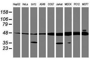 Image no. 7 for anti-Tubulin, alpha-Like 3 (TUBAL3) (AA 150-446) antibody (ABIN1490956)