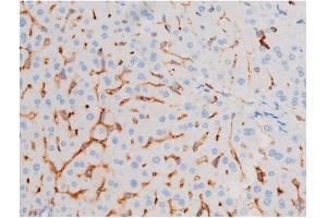 ABIN6267486 at 1/200 staining Mouse liver tissue sections by IHC-P. (IRS1 anticorps  (pSer639))
