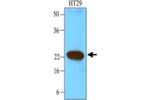 Western blot analysis of cell lysates of HT-29 (40 ug) were resolved by SDS - PAGE , transferred to NC membrane and probed with CIB1 monoclonal antibody , clone 1D1 (1 : 1000) . (CIB1 anticorps)