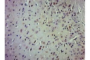 Paraformaldehyde-fixed, paraffin embedded mouse brain; Antigen retrieval by boiling in sodium citrate buffer (pH6. (TrkA, B, C (pTyr516) anticorps)