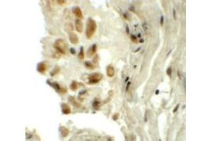 Immunohistochemistry (IHC) image for anti-tRNA-YW Synthesizing Protein 1 Homolog (TYW1) (C-Term) antibody (ABIN1030788) (TYW1 anticorps  (C-Term))