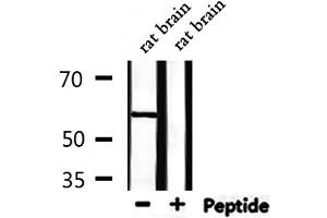 Western blot analysis of extracts from rat brain, using USP30 Antibody.