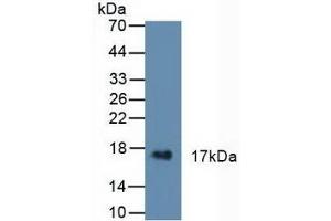 Detection of CST6 in Human Urine using Polyclonal Antibody to Cystatin 6 (CST6)