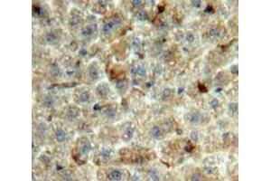 Used in DAB staining on fromalin fixed paraffin-embedded Liver tissue (GDF2 anticorps  (AA 22-178))