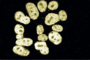 Immunofluorescence staining of SK-N-MC (Human neuroblastoma, ATCC HTB-10). (CTBP2 anticorps  (AA 361-445))