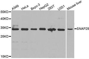Western blot analysis of extracts of Jurkat cell line, using SNAP29 antibody. (SNAP29 anticorps  (AA 1-258))