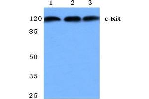 Western blot analysis of CD117/c-Kit antibody at 1/500 dilution in: Lane 1: MCF-7 cell lysate. (KIT anticorps)