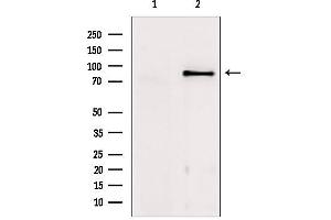 Western blot analysis of extracts from mouse brain, using TACC1 Antibody. (TACC1 anticorps  (N-Term))