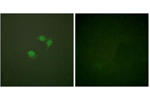Immunofluorescence analysis of NIH/3T3 cells, using Sumo1 antibody. (SUMO1 anticorps  (N-Term))