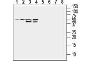 Western blot analysis of human MDA-MB-231 breast adenocarcinoma cell line lysate (lanes 1 and 5), human HepG2 hepatocellular carcinoma cell line lysate (lanes 2 and 6), human K562 chronic myeloid leukemia cell line lysate (lanes 3 and 7) and human Jurkat T-cell leukemia cell line lysate (lanes 4 and 8): - 1-4.