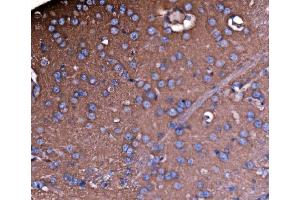 IHC analysis of NEAS/SPTAN1 using anti-NEAS/SPTAN1 antibody (ABIN7600436). (SPTAN1 anticorps  (AA 1916-2472))