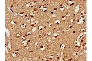 Immunohistochemistry of paraffin-embedded human brain tissue using ABIN7147854 at dilution of 1:100