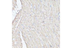 Immunohistochemistry of paraffin-embedded mouse heart using MTOR antibody.