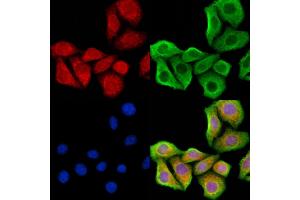ABIN6262367 and ABIN6278302 staining Hela cells by IF/ICC. (HRH2 anticorps  (Internal Region))
