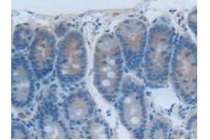 Detection of CEACAM1 in Rat Intestine Tissue using Polyclonal Antibody to Carcinoembryonic Antigen Related Cell Adhesion Molecule 1 (CEACAM1) (CEACAM1 anticorps  (AA 36-145))