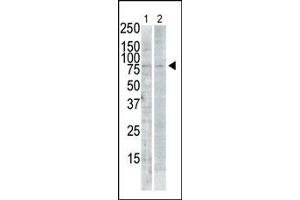 The anti-SNK C-term Pab (ABIN391375 and ABIN2841386) is used in Western blot to detect SNK in A-treated Pam212 cell lysate (lane 1) and rat testis tissue lysate (lane 2). (PLK2 anticorps  (C-Term))
