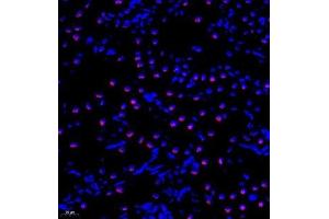 Immunofluorescence analysis of paraffin embedded rat kidney using TIP49A (ABIN7075488) at dilution of 1: 300
