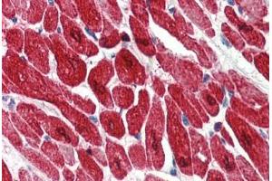 Human Heart (formalin-fixed, paraffin-embedded) stained with TNNI3 antibody ABIN334276 at 2. (TNNI3 anticorps)