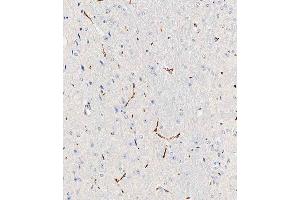 Immunohistochemical analysis of paraffin-embedded mouse brain tissue using (ABIN1539189 and ABIN2838276) performed on the Leica® BOND RXm.