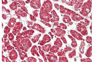 Rabbit Anti-EIF4H antibody  Formalin Fixed Paraffin Embedded Tissue: Human Heart Primary antibody Concentration: 1:200 Secondary Antibody: Donkey anti-Rabbit-Cy3 Secondary Antibody Concentration: 1:200 Magnification: 20x Exposure Time: 0.