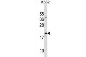 Western Blotting (WB) image for anti-Activated RNA Polymerase II Transcriptional Coactivator p15 (SUB1) antibody (ABIN3001149) (SUB1 anticorps)