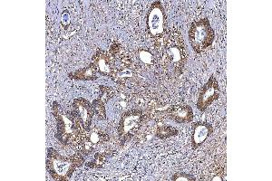 IHC analysis of TRMT2B using anti-TRMT2B antibody (ABIN7599456). (TRMT2B anticorps  (AA 1-504))