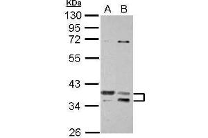 WB Image Sample (30 ug of whole cell lysate) A: Jurkat B: K562 10% SDS PAGE antibody diluted at 1:1000 (TSFM anticorps)