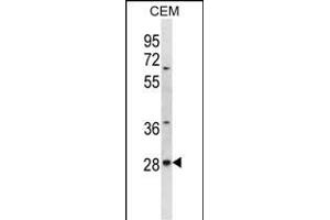 ALKBH4 Antibody (Center) (ABIN656701 and ABIN2845934) western blot analysis in CEM cell line lysates (35 μg/lane). (ALKBH4 anticorps  (AA 88-117))