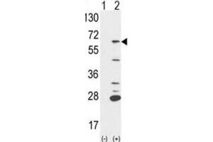 Western Blotting (WB) image for anti-Protein-tyrosine Phosphatase 1C (PTPN6) antibody (ABIN3001647) (SHP1 anticorps)