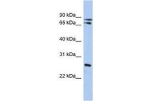 Image no. 1 for anti-Ovo-Like 2 (OVOL2) (C-Term) antibody (ABIN6742352) (OVOL2 anticorps  (C-Term))