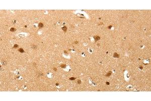 Immunohistochemistry of paraffin-embedded Human brain tissue using TNN Polyclonal Antibody at dilution 1:40 (Tenascin N anticorps)