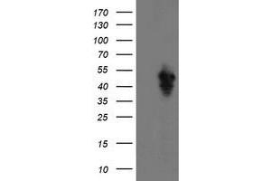 HEK293T cells were transfected with the pCMV6-ENTRY control (Left lane) or pCMV6-ENTRY SERPINE2 (Right lane) cDNA for 48 hrs and lysed.
