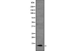 Western blot analysis of CCL20 expression in HEK293 cells ,The lane on the left is treated with the antigen-specific peptide. (CCL20 anticorps  (Internal Region))