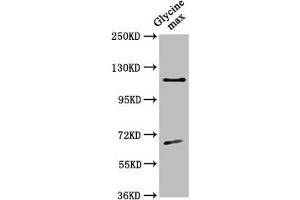 Western Blot Positive WB detected in: Glycine max leaf tissue All lanes: CESA4 antibody at 1:500 Secondary Goat polyclonal to rabbit IgG at 1/50000 dilution Predicted band size: 120 kDa Observed band size: 120 kDa (CESA4 anticorps  (Catalytic Subunit 4))