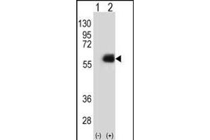 Western blot analysis of NMT2 (arrow) using rabbit polyclonal NMT2 Antibody (E31) (ABIN389095 and ABIN2839287). (NMT2 anticorps  (N-Term))
