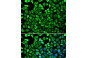 Immunofluorescence analysis of HeLa cells using CDA Polyclonal Antibody
