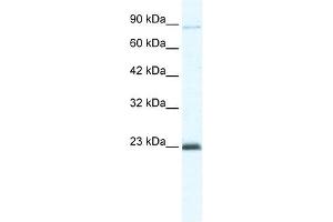 MCM4 antibody used at 5 ug/ml to detect target protein. (MCM4 anticorps  (C-Term))