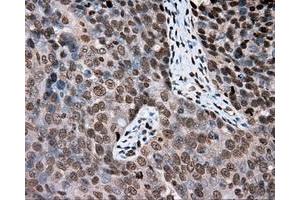 Immunohistochemical staining of paraffin-embedded Kidney tissue using anti-DAPK2 mouse monoclonal antibody. (DAPK2 anticorps)