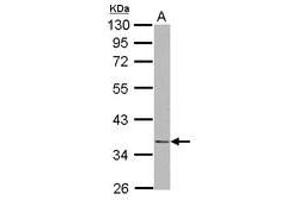 NudE Neurodevelopment Protein 1 (NDE1) (AA 1-203) antibody